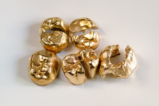 Zahngold verkaufen